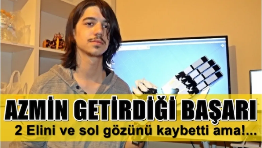 Deney yaparken 2 elini ve gözünü kaybetti ama hiç vazgeçmedi