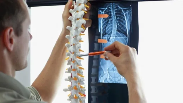 Skolyoz hastalığı, tanı ve tedavi güncel ve yeni süreçler!